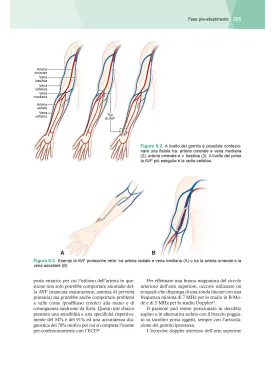 ULTRASONOGRAFIA VASCOLARE