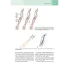 ULTRASONOGRAFIA VASCOLARE