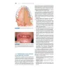 Odontostomatologia per l’igienista dentale - Basi Anatomo-Cliniche e Protocolli Operativi