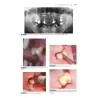 Odontostomatologia per l’igienista dentale - Basi Anatomo-Cliniche e Protocolli Operativi