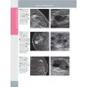 La mammella. Diagnostica per immagini