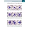 Casi clinici in Medicina di Laboratorio - Ematologia