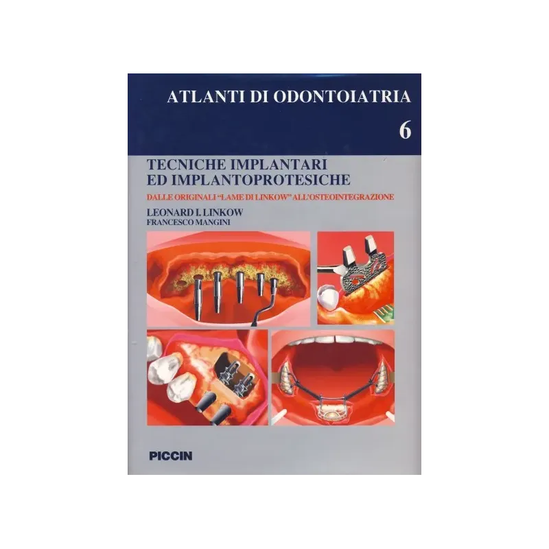 Tecniche Implantari ed Implantoprotesiche - Vol . 6