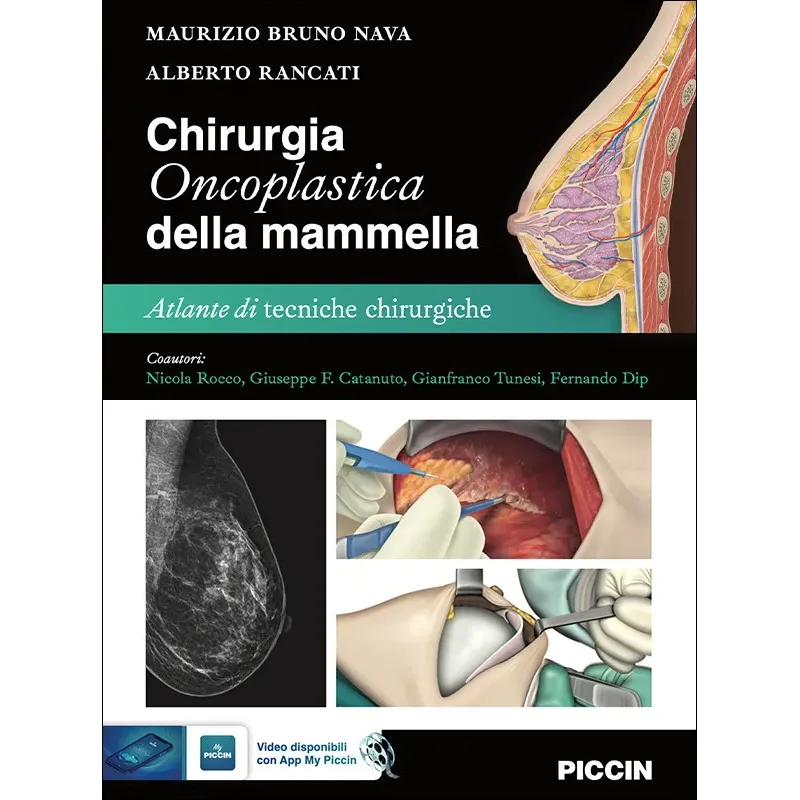 Chirurgia Oncoplastica della Mammella-Atlante di tecniche chiurgiche