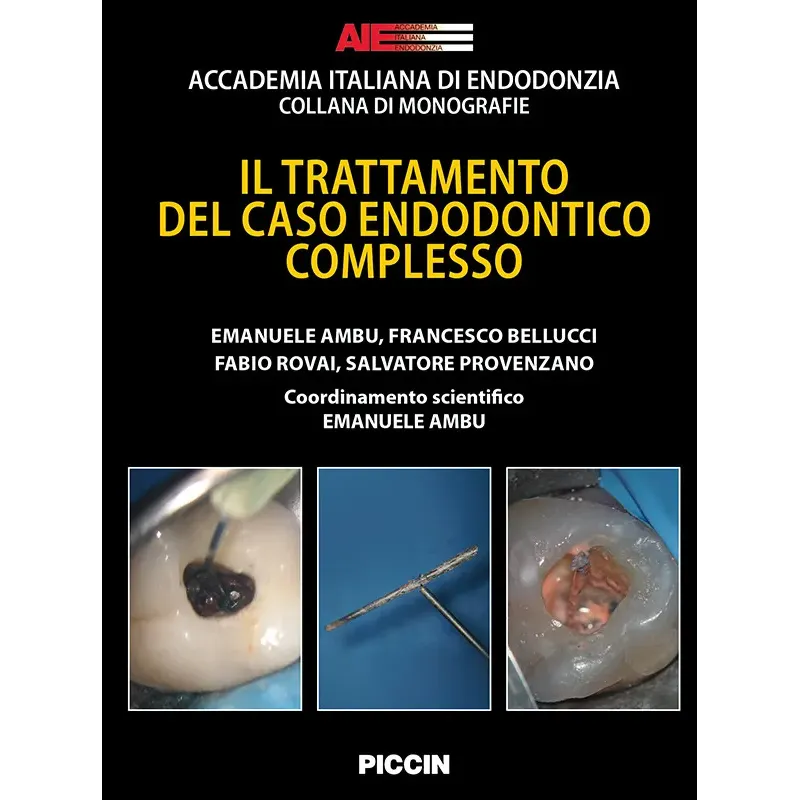 IL TRATTAMENTO DEL CASO ENDODONTICO COMPLESSO