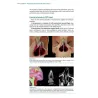 The Nasal Septum