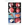 The Nasal Septum