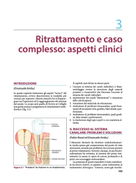 IL TRATTAMENTO DEL CASO ENDODONTICO COMPLESSO