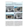 IL TRATTAMENTO DEL CASO ENDODONTICO COMPLESSO