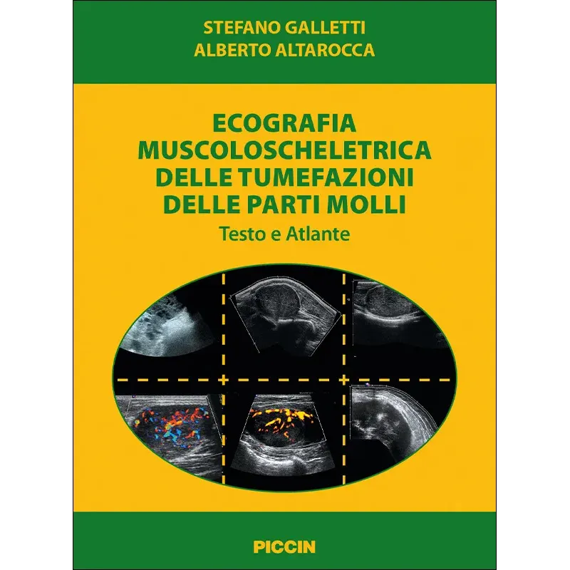Ecografia muscoloscheletrica delle tumefazioni delle parti molli