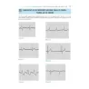 ECG WORKOUT - ESERCIZI DI INTERPRETAZIONE delle ARITMIE CARDIACHE