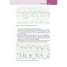 La lettura fisiopatologica della cardiotocografia intrapartum