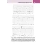 La lettura fisiopatologica della cardiotocografia intrapartum