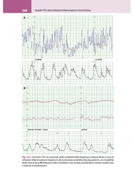 La lettura fisiopatologica della cardiotocografia intrapartum