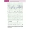 La lettura fisiopatologica della cardiotocografia intrapartum