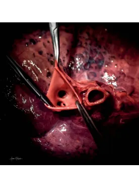 Anatomia Fotografica