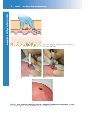 Manuale di Dermatologia di Rook