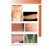 Manuale di Dermatologia di Rook