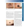 Manuale di Dermatologia di Rook