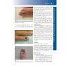 Manuale di Dermatologia di Rook