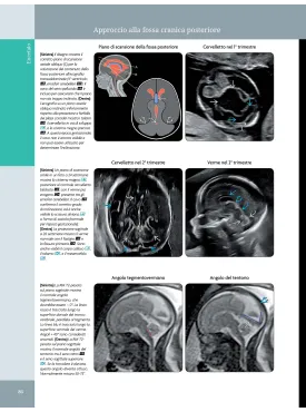 Ostetricia - Diagnostica per immagini