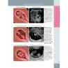 Ostetricia - Diagnostica per immagini