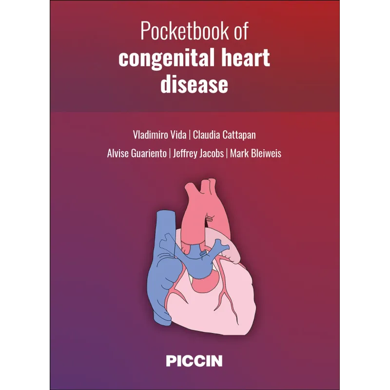 Pocketbook of congenital heart disease