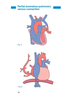 Pocketbook of congenital heart disease