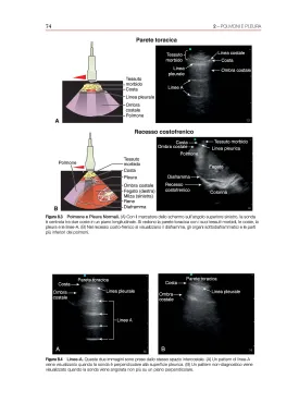 Ecografia Point-of-Care
