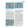 Curriculum di base. Gestione delle stomie