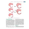Curriculum di base. Gestione delle stomie