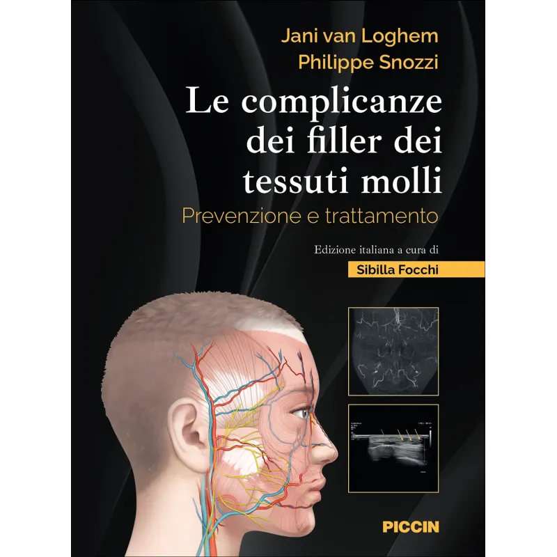 Le complicanze dei filler dei tessuti molli. Prevenzione e trattamento
