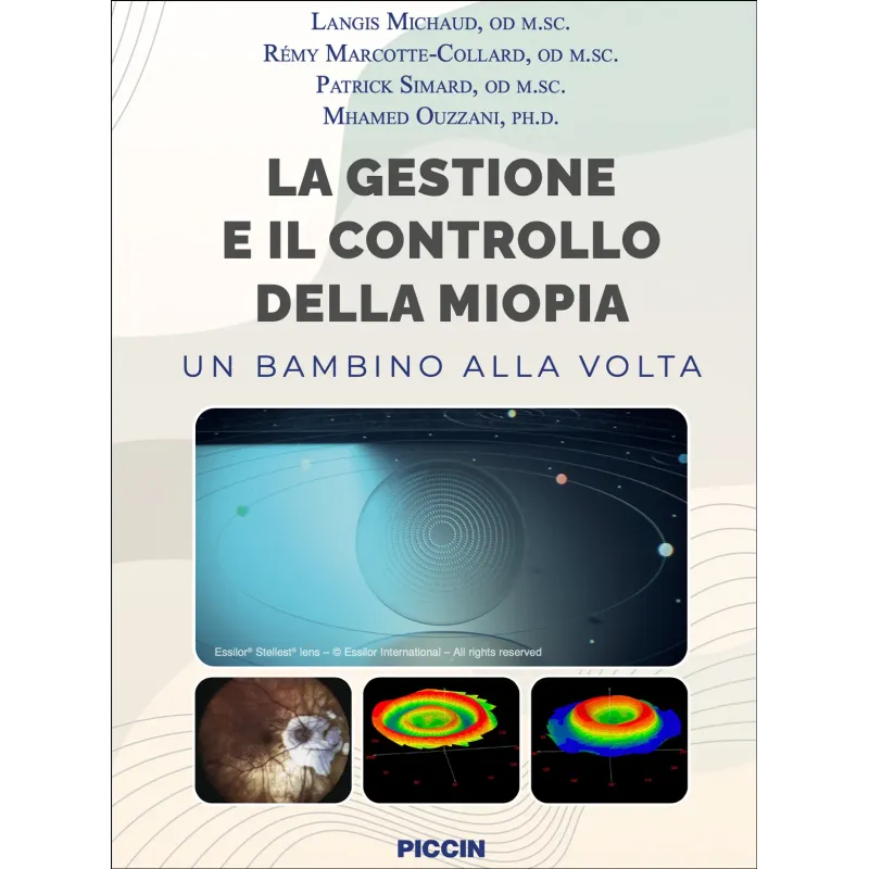La gestione e il controllo della miopia