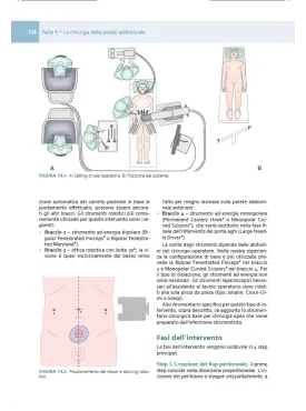 Chirurgia Robotica