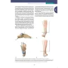 Brukner & Khan’s Medicina clinica dello sport. Infortuni