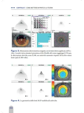 La gestione e il controllo della miopia
