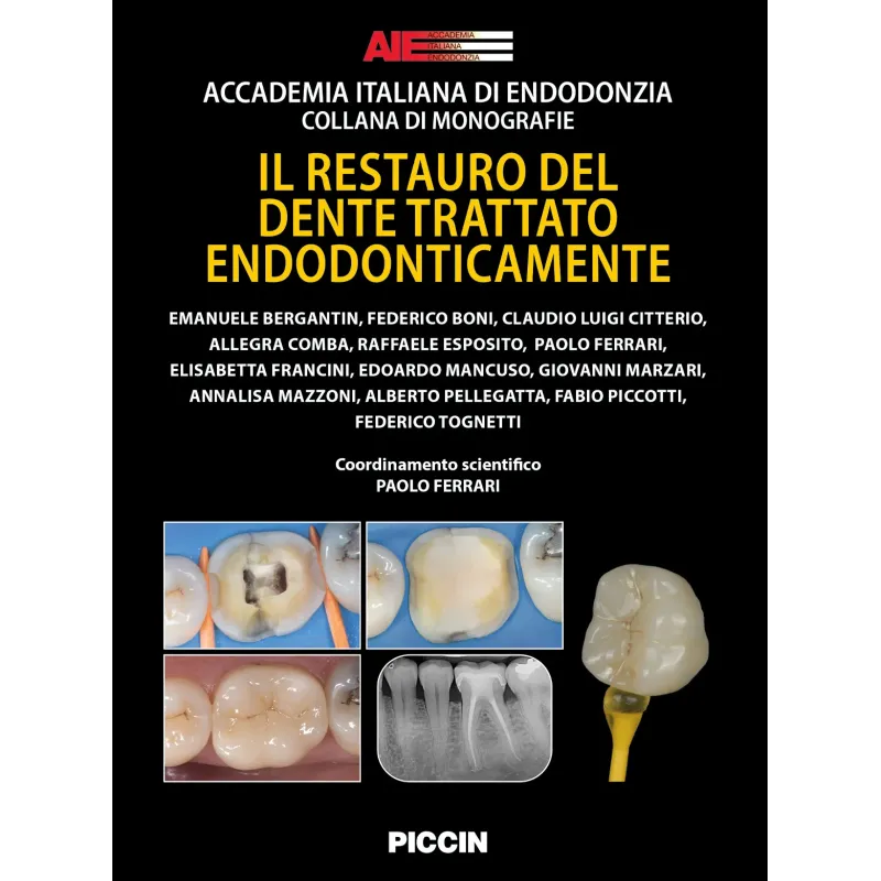 IL RESTAURO DEL DENTE TRATTATO ENDODONTICAMENTE