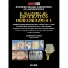 IL RESTAURO DEL DENTE TRATTATO ENDODONTICAMENTE
