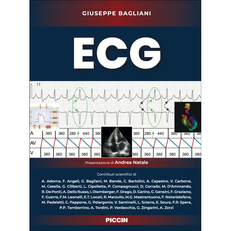 ECG