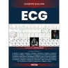 ECG
