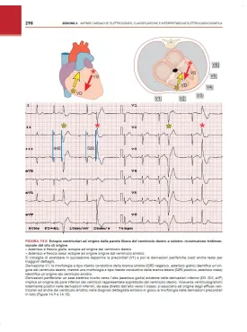 ECG