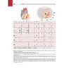 ECG