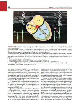 ECG