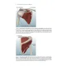 Manuale teorico di tecniche infiltrative ecoguidate nelle patologie muscolo-scheletriche