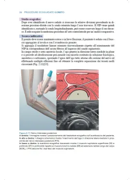 Manuale teorico di tecniche infiltrative ecoguidate nelle patologie muscolo-scheletriche