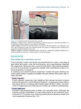 Manuale teorico di tecniche infiltrative ecoguidate nelle patologie muscolo-scheletriche