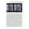 Apparecchiature e radiologia interventistica