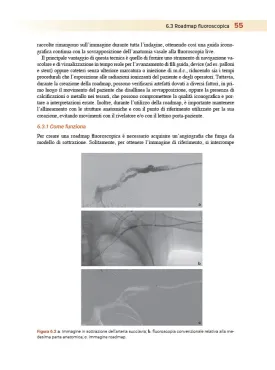 Apparecchiature e radiologia interventistica