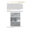 Apparecchiature e radiologia interventistica