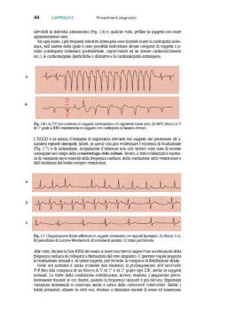 Le Aritmie Cardiache - Meccanismi, diagnosi e terapia